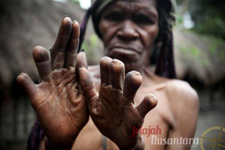 Tradisi Potong Jari, Simbol Kesetian di Papua
